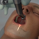 (Video) Yomi, The First Robotic Dental Surgery System Now Cleared by FDA