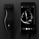 (Video) Pocket-sized, Affordably-Priced Ultrasound Connects to an iPhone - Butterfly iQ
