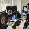 China’s Infervision is Helping 280 Hospitals Worldwide Detect Cancers