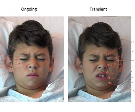 Software “Reads” Kids’ Expressions to Measure Pain Levels