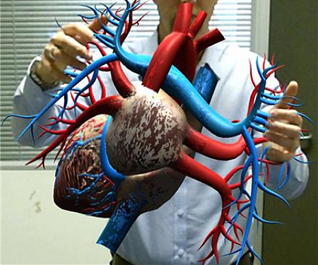 Augmented Reality System to Help Understand Medical Conditions and Assist in Patient Education