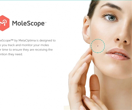 (Video) Smartphone Attachment Spots Skin Cancer - MoleScope
