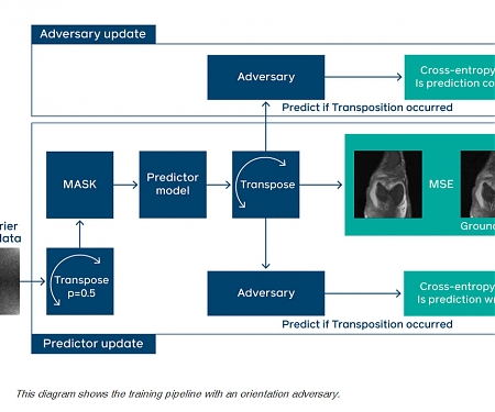 (Paper) FastMRI Leverages Adversarial Learning to Remove Image Artifacts