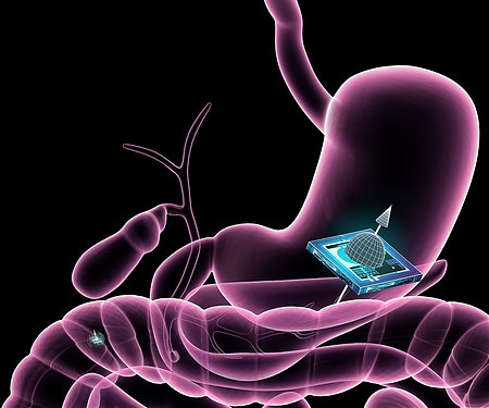 Medicine of the Future : New Microchip Technology Could Be Used to Track Smart Pills