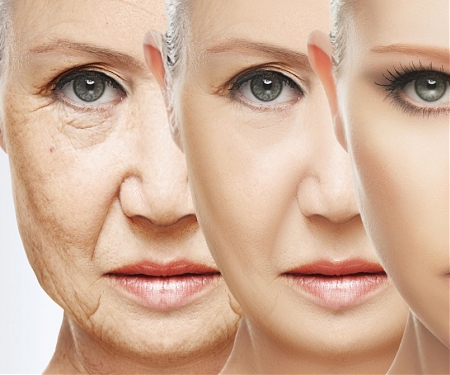 (PDF) Smoothing The Wrinkles in Our Cells Could be a Key to Reversing Aging