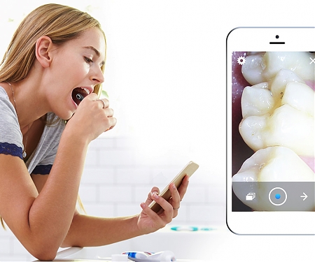 High Definition Dental Care - MTG Dental Camera