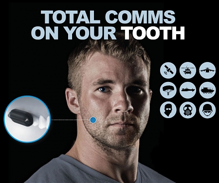 Molar Mic Puts a Wireless Comms System Inside the Mouth