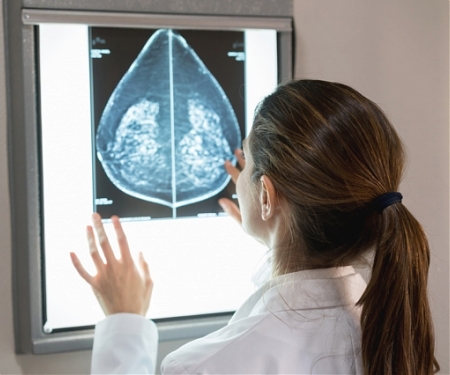 MIT’s AI Accurately Identifies Breast Cancer Like A Radiologist Would