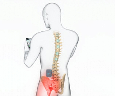 St. Jude Medical’s Invisible Trial System Uses iPads to Control Pain Relieving Neurostimulator
