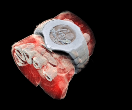 First 3D Colour X-Ray of a Human Using CERN Technology - Pixabay