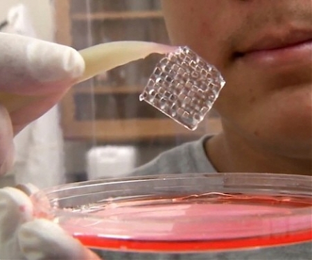 A 3-D Printing Solution for a Major Women's Health Issue