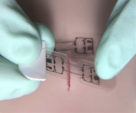 Bandage-Like Gadget Could Make Stitches and Staples a Thing of the Past - microMend