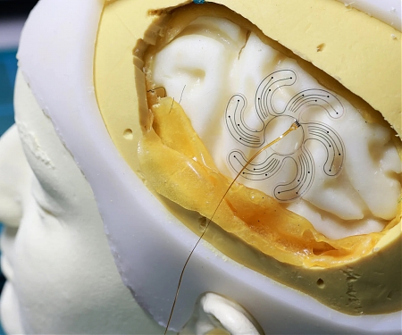 (Video) EPFL - This Soft Robot Unfurls Inside the Skull