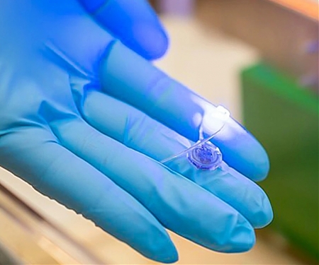 (Paper) Stomach Implant Tells Your Brain You're Not Hungry