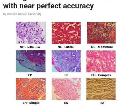Nearly 100% of Cancer Identified by New AI, Easily Outperforming Doctors