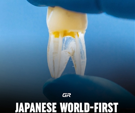 World's First Tooth-Regenerating Drug to Enter Testing in Japan