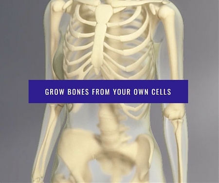 (Video) EpiBone Raises Funding Round for Regenerative Medicine
