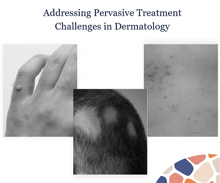 Veradermics Raises $75M And Initiates Phase 2/3 Trial for Hair Loss