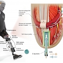 (Video) MIT - A Bionic Knee Integrated Into Tissue Can Restore Natural Movement