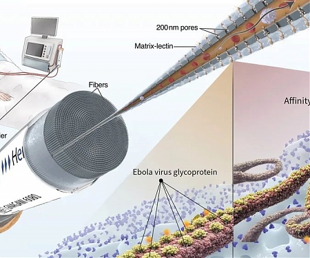 Could This Blood-Filtering Device Help Treat Ebola ?