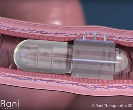 Rani Therapeutics Nets $69M to Transform Injections Into Its Easy-to-Swallow 'Robotic Pill'