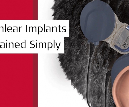 World’s First Fully Implanted Cochlear Implant Reaches Patients