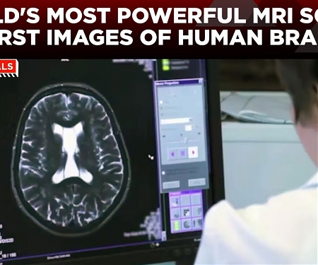 (Video) World's Most Powerful MRI Machine Captures First Stunning Brain Scans