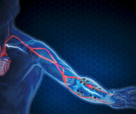 Blood Pressure E-Tattoo Promises Continuous, Mobile Monitoring