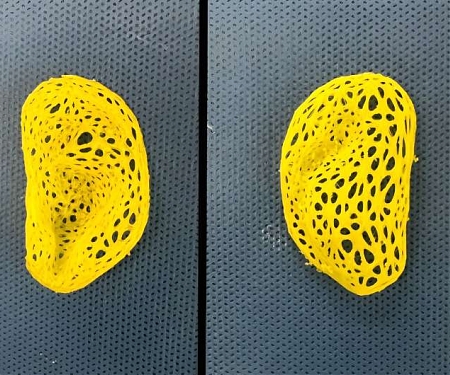Researchers Produce Grafts That Replicate The Human Ear