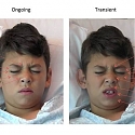 Software “Reads” Kids’ Expressions to Measure Pain Levels