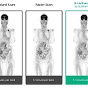 SubtlePET Artificial Intelligence Software Enhances PET Scans, Saves Time in Scanner