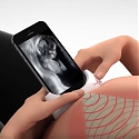 (Video) PulseNmore At-Home Tele-Ultrasound for Pregnant Women