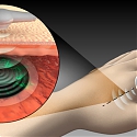 (Paper) Biocompatible Battery for Medical Implants is Charged via Ultrasound