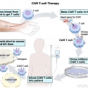 What Is Next in CAR-T Cell Therapy ?