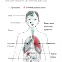 Coronavirus Overtakes Sars