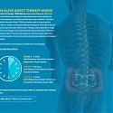 (Video) Bayer Unveils Aleve Direct Therapy TENS Back Pain Relief System