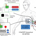 (Video) Highly Dexterous Prosthetic Arm Gives Users Sensations - DeTOP