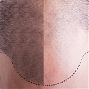 (Paper) Advance in Bulk Hair-Regrowth Technology Keeps Follicles Coming Thicker and Faster