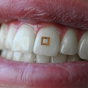 Scientists Develop Tiny Tooth-Mounted Sensors That Can Track What You Eat