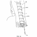 (Patent) L’Oréal Files a Patent for a Flexible Heating Device