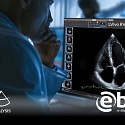 (Video) DiA Imaging Analysis Adds $14M for Its AI Ultrasound Solution