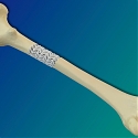 Fraunhofer - Bioactive Composite Supports Healing of Broken Bones