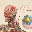 MIT - New Therapeutic Brain Implants Could Defy The Need For Surgery