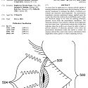 (Patent) IBM Seeks to Patent an Ultrasound Emitting Contact Lens