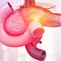 Harvard - AI Predicts Future Pancreatic Cancer