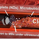 (Paper) Nanodroplets and Ultrasound 'Drills' Prove Effective at Tackling Tough Blood Clots
