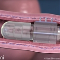 Rani Therapeutics Nets $69M to Transform Injections Into Its Easy-to-Swallow 'Robotic Pill'