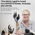 (Video) This Bionic Hand is Fused to a Woman’s Bones, Muscles, and Nerves
