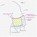 (Patent) A New Apple Patent Demonstrates An Advanced Blood Pressure Device